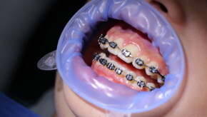 Orthodontie